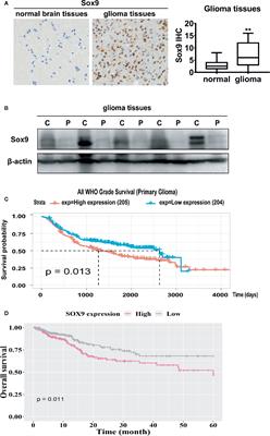 TGF-β Signaling Promotes Glioma Progression Through Stabilizing Sox9